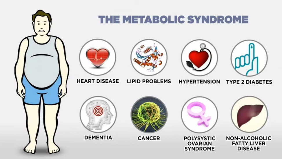 Bioglutide NA-931 Comprehensive Metabolic Targeting | Shaanxi BLOOM Tech Co., Ltd Bioglutide NA-931 Comprehensive Metabolic Targeting | Shaanxi BLOOM Tech Co., Ltd