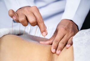 Acupuncture for Seniors in South Florida at Primary Medical Care Center